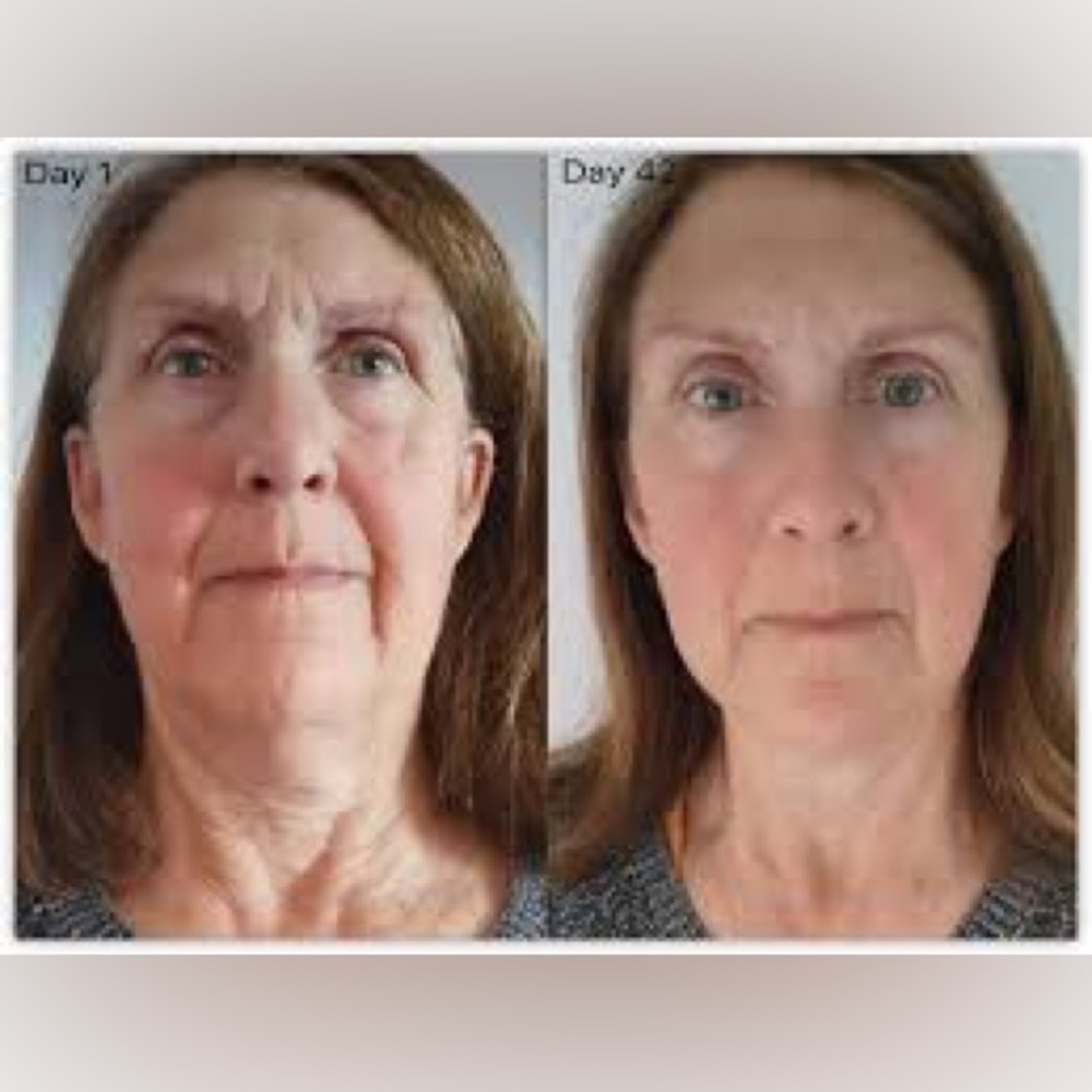 COPY - Collagen Elixir - Picture 4 of 11